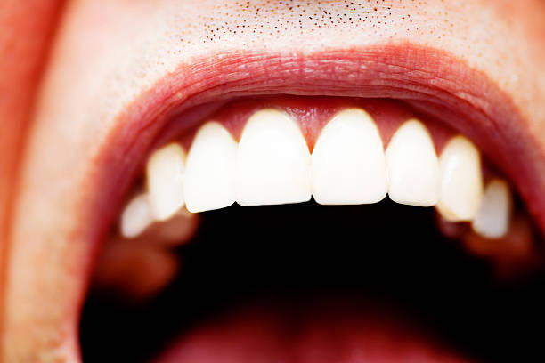 i call out because i care